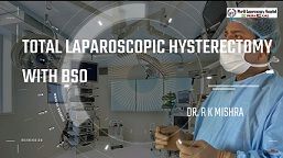 Laparoscopic Myomectomy and Salpingo-oophorectomy with Palmer's Point and Extraction by Colpotomy