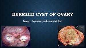 FELLOWSHIP IN UPPER AND LOWER GI ENDOSCOPY FOR VETERINARY DOCTORS