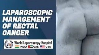 Laparoscopic management of Rectal Cancer