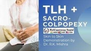 TLH + Sacrocolpopexy Skin to Skin Surgical Video