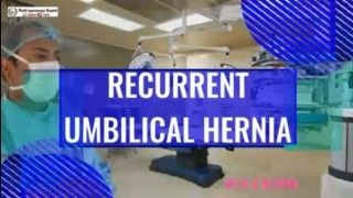 Laparoscopic Repair of Recurrent Umbilical Hernia