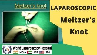 Mastering the Laparoscopic Meltzer's Knot: Advanced Suturing Techniques