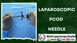 Revolutionizing PCOD Treatment: The Laparoscopic Needle Advantage