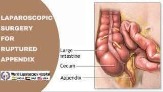 Comprehensive Fellowship in Laparoscopic Bariatric Surgery at World Laparoscopy Hospital