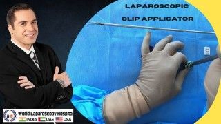 Precision and Convenience in Laparoscopic Surgery: The Laparoscopic Clip Applicator