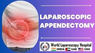 Laparoscopic appendectomy is a minimally invasive surgery used to remove the appendix.