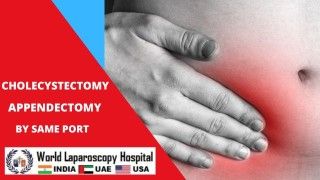 Minimally Invasive Surgery: Simultaneous Cholecystectomy and Appendectomy through a Single Incision