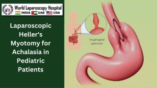 Minimally invasive precision: Laparoscopic trocars and cannula