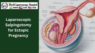 Laparoscopic Ovarian Cystectomy - Aspiration with Transparent Needle