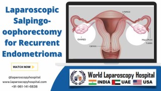 Laparoscopic Endometrioma Treatment: Ultrasonic & H2O2 Therapy