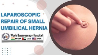 Minimally Invasive Umbilical Hernia Repair with Mishra's Knot and Dual Mesh