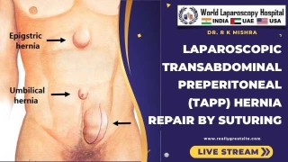 Advanced Suturing in Laparoscopic Transabdominal Preperitoneal (TAPP) Hernia Repair